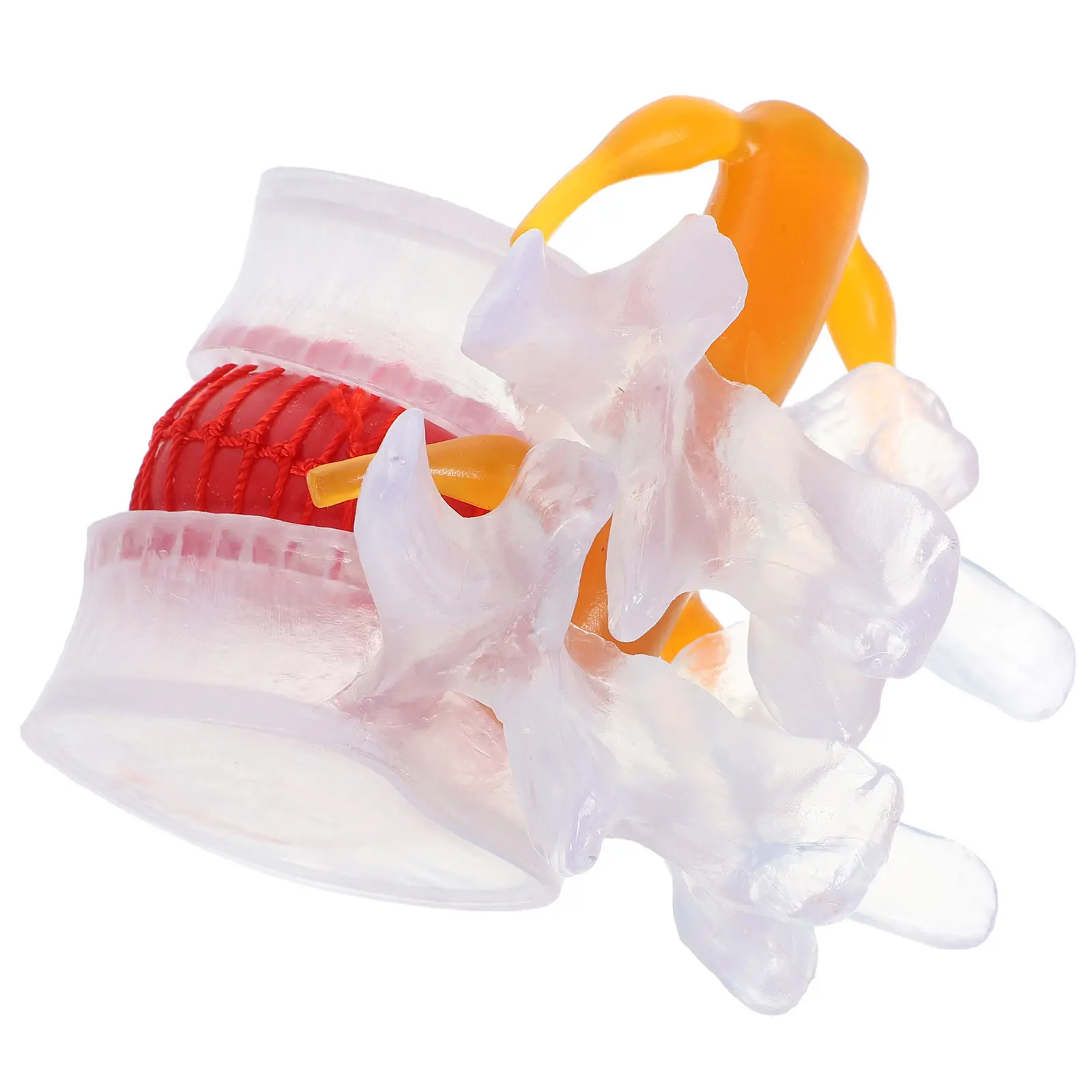 human-lumbar-spine-herniation-transparent-simulation-resin-rubber-teaching-display-clinical-demonstration-rehabilitation