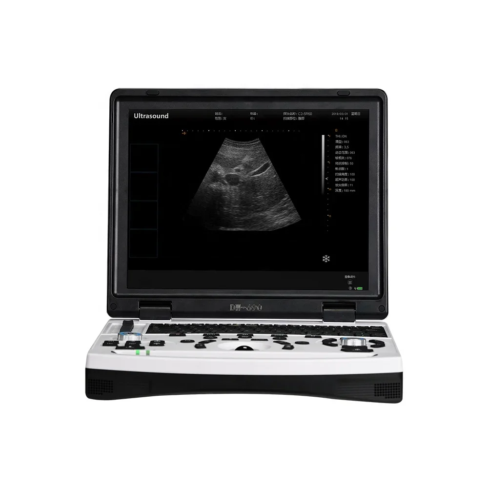 Dawei b/w ultrasound veterinary full digital ultrasound machine