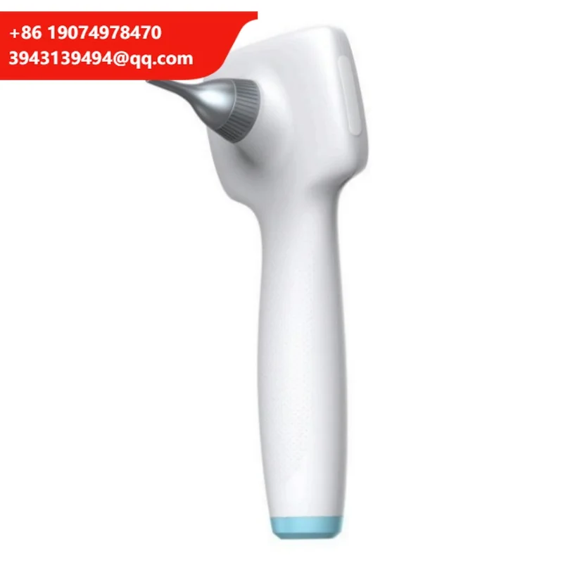 Medical ENT Adjustable LED Light USB Digital Video Otoscope With Camera