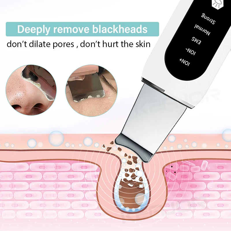 Ultrasonic Skin Scrubber Deep Face Cleaning Peeling Blackhead Remover Ultrasonic Ion Ance Pore Cleaner Facial Shovel Cleanser