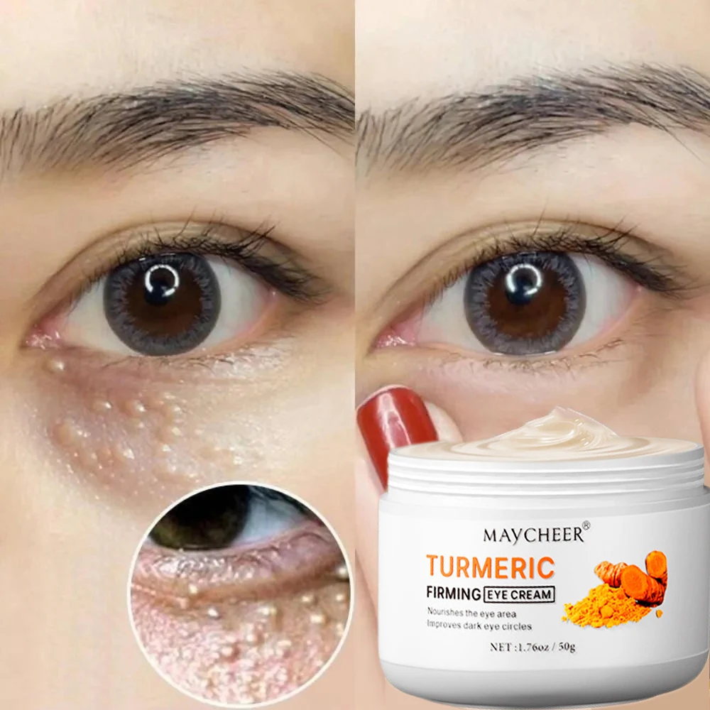 

Turmeric Eye Cream Remove Fat Granule & Bags Puffiness Anti-Wrinkle Lift Firming Lightening Dark Circles Moisturizer Eye Care