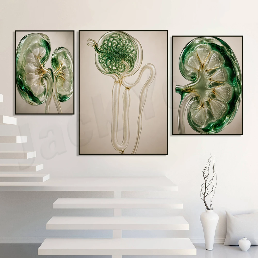 Anatomical kidney prints, kidney disease prints, urinary system art, dialysis clinic/medical office posters