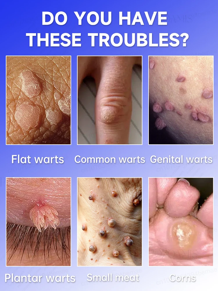 Fʟᴀᴡʟᴇss sᴋɪɴ