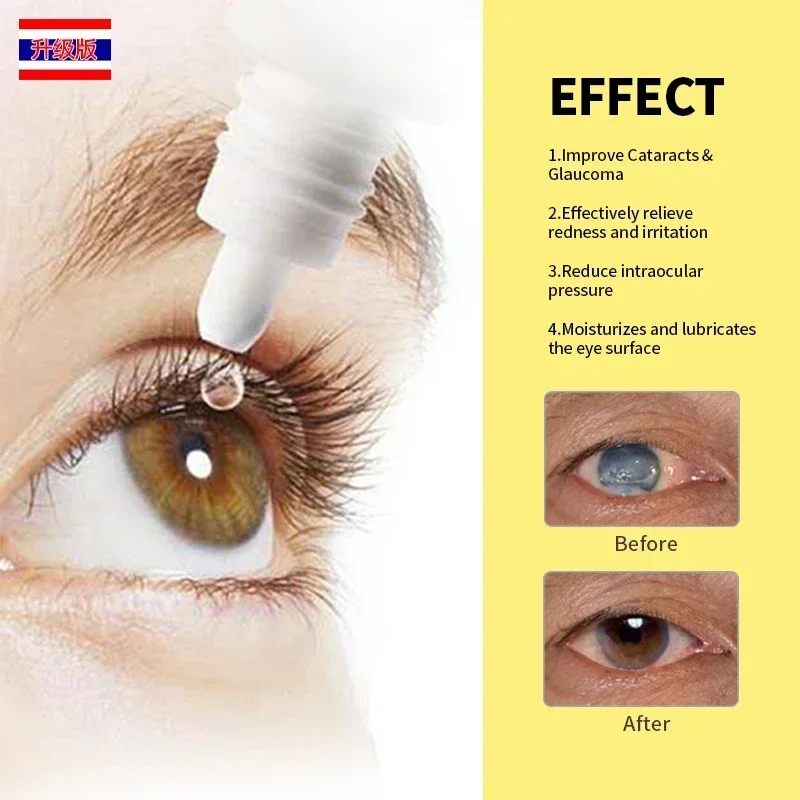 Cataract Eye Drops Vision Lutein Cleaner Apply To Eyes Pain Dry Itchy Fatigue Removal Treatment Thailand Formula Care Medicine