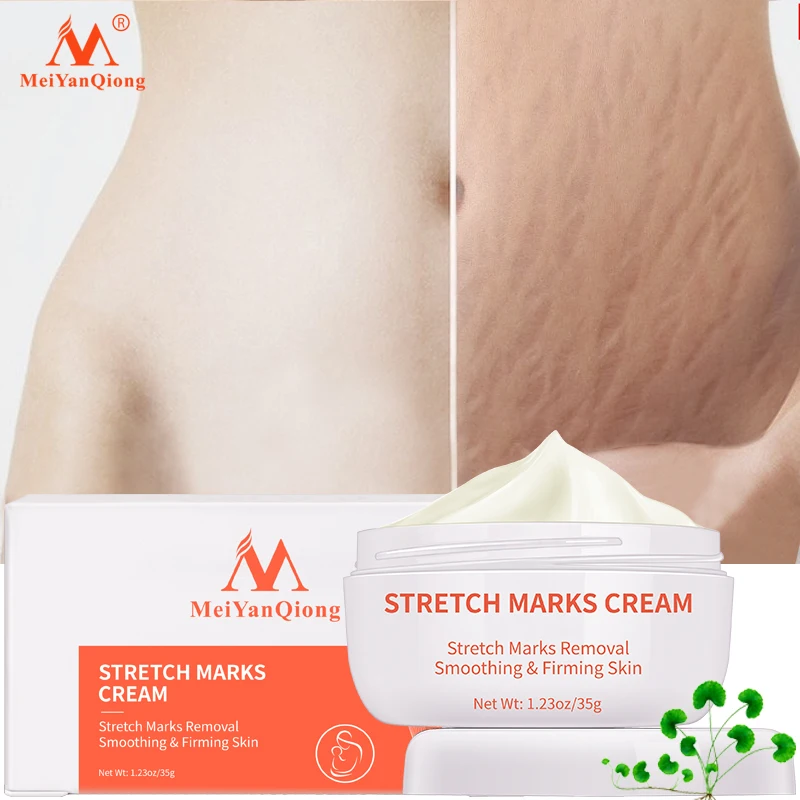 

Skin Smooth Repair Cream Remove Stretch Marks Treatment Maternity Repair Anti-Aging Anti-Wrinkles Firming Stretch Mark