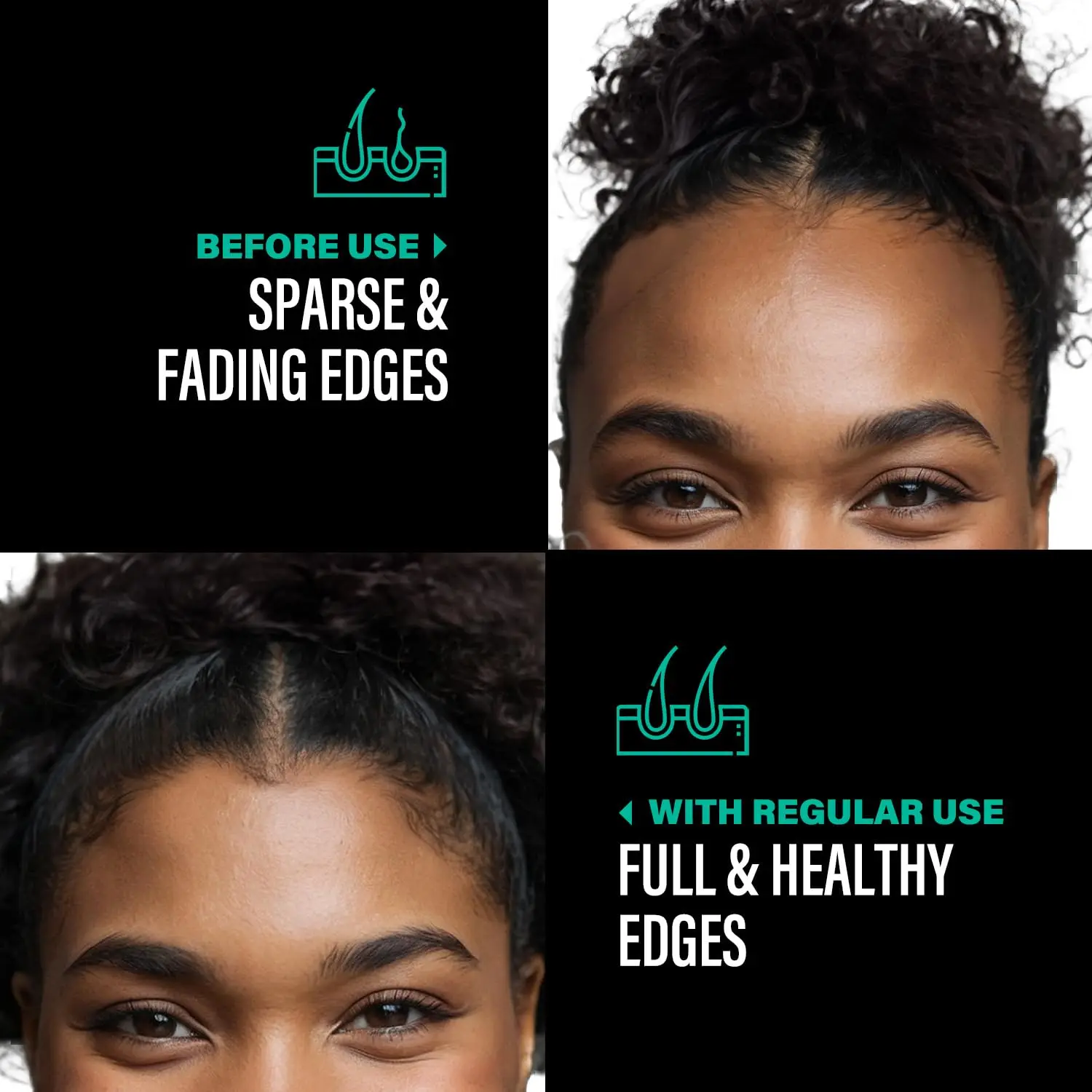 Thumbnail 4 - #64 Hair Loss Treatments Comparison Guide
