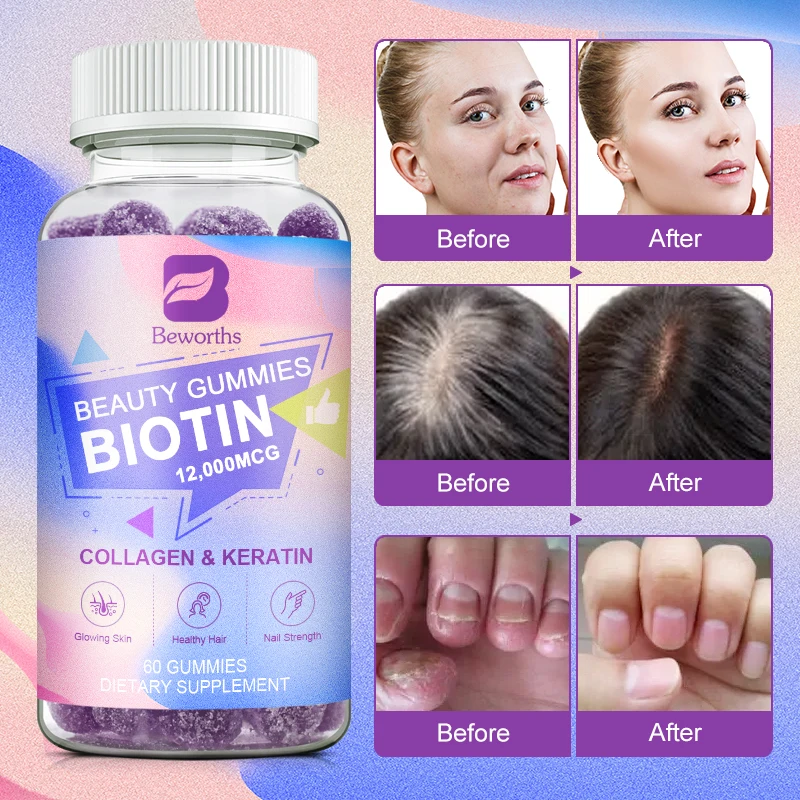 BBEEAAUU Collagen Biotin Gummies Support Healthy Hair, Skin and Nails,Hair Growth Strengthen Nails and Hair Roots