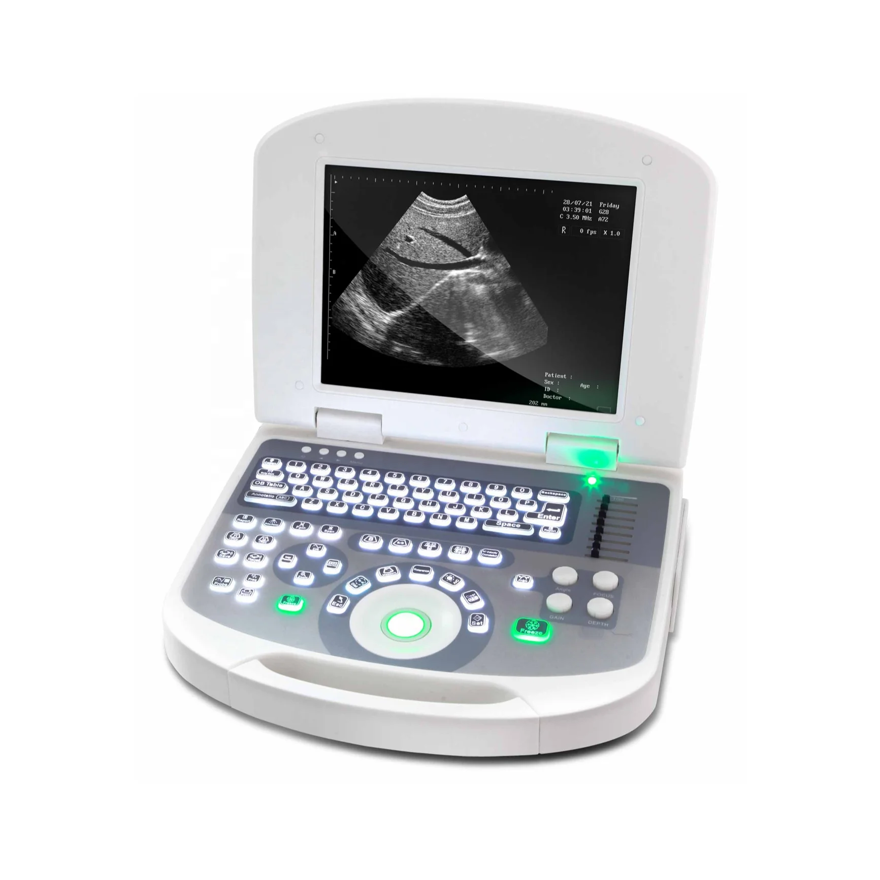 Yd-3w-2100 is a high-end digital portable ultrasonic diagnostic systemWith electron convex array probeB/W Medical Ultrasound