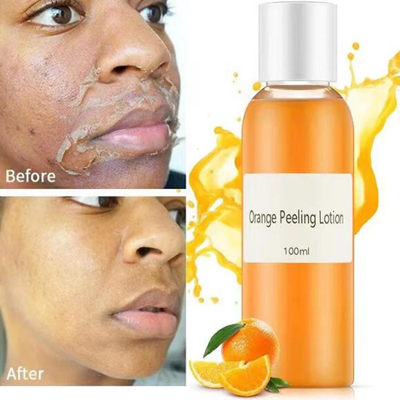 

Strong Effective Orgainc Orange Peel Lotion for Whitening Moisturizer Bleaching Face Body Lightening Cream Underarm Armpit Legs