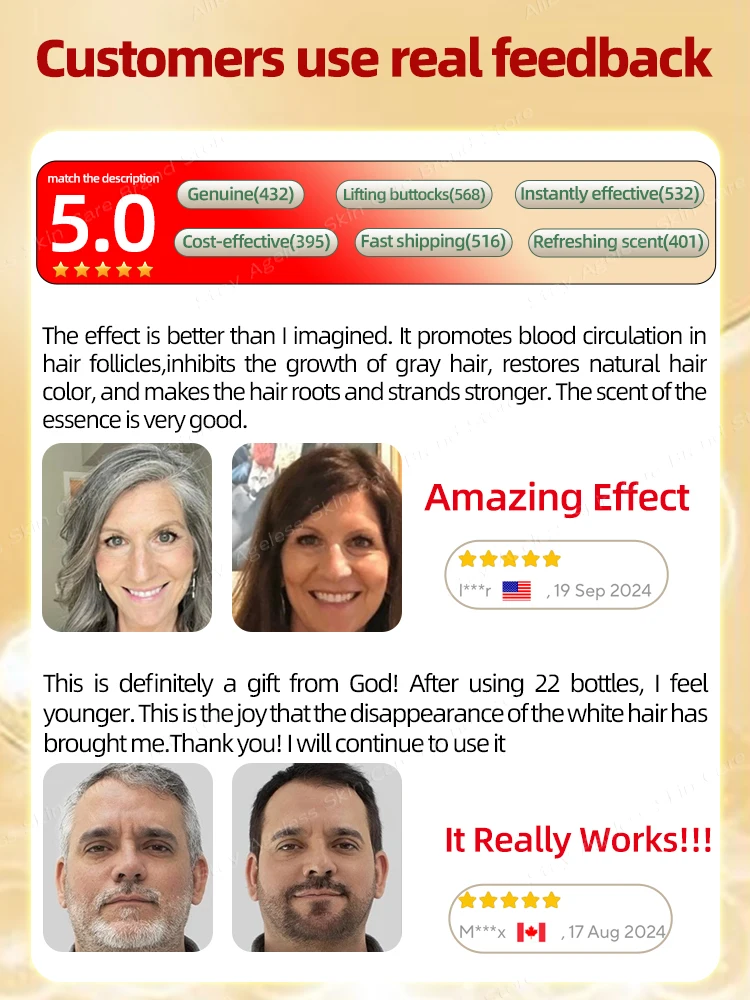 قاتل الشعر الأبيض، يزيل الشعر الرمادي ويعيد لون الشعر الطبيعي خلال 7 أيام #4