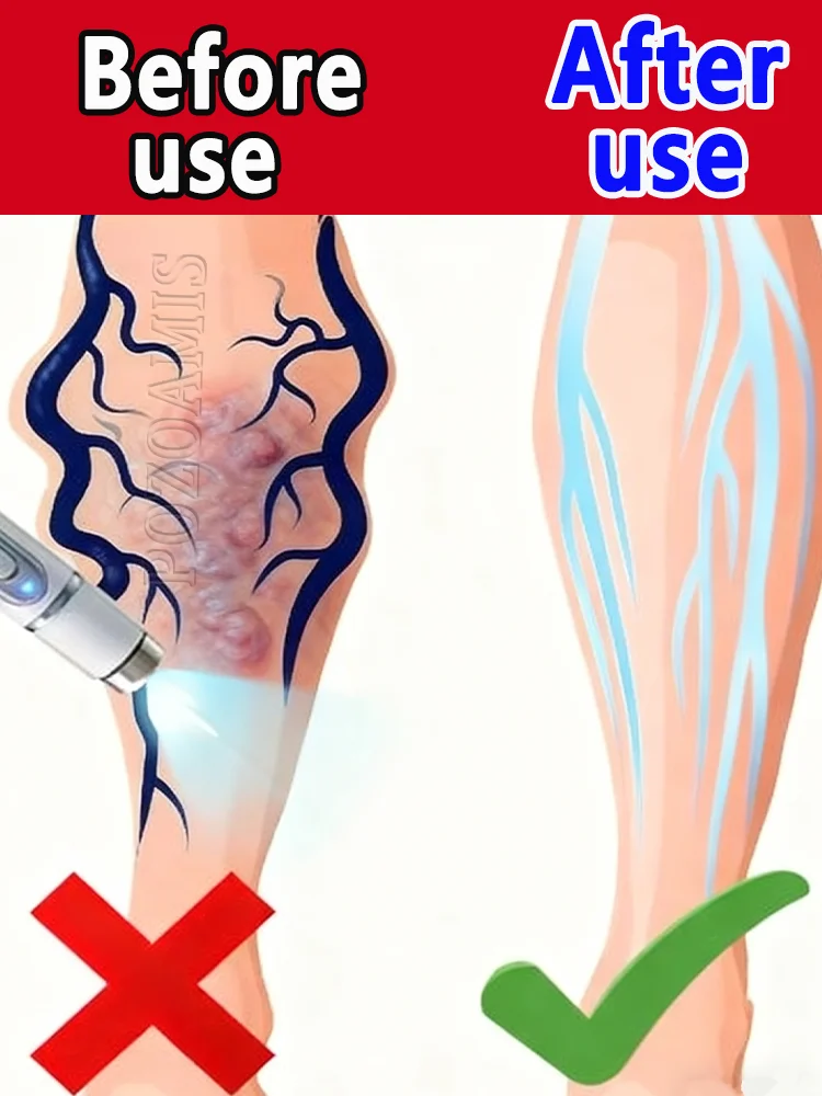 

Blue version blue pen, 2025