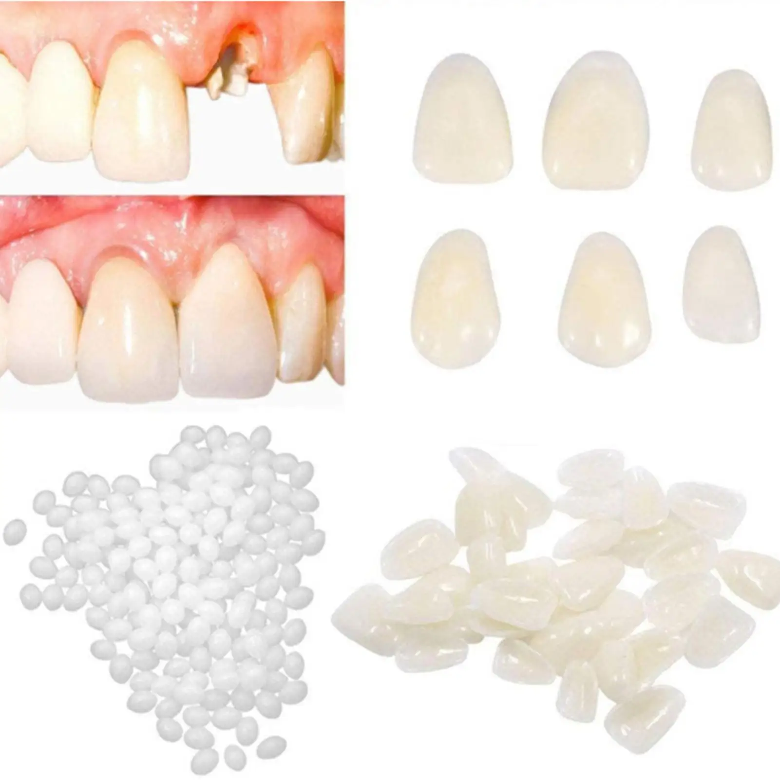 Tooth Repair Kit Natural Color DIY Moldable resin denture particles Fake Teeth Beads Broken Tooth Repair Kit for Missing Chipped