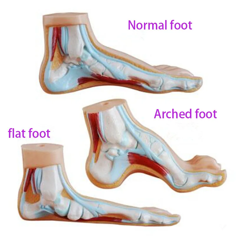 PVC Material Normal Foot Flat Foot Arched Foot Model Foot Pathology Model Human Foot Muscle Anatomy Model