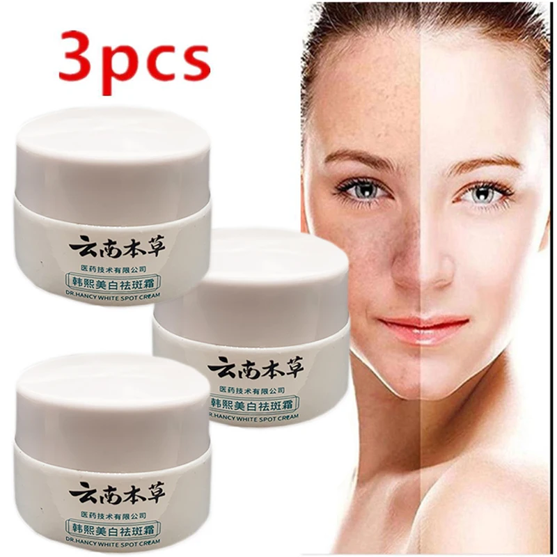 3pcs 20g Anti Freckle Cream Smooth Face Care Dark Spot Lightening Blemish Whitening Removal Dressing Reduces Age Spots Cream