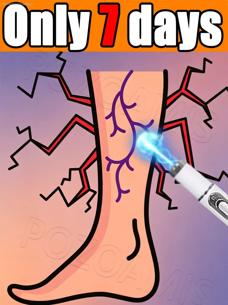 

Все, что может помочь улучшить состояние вен в ногах, может быть использовано.