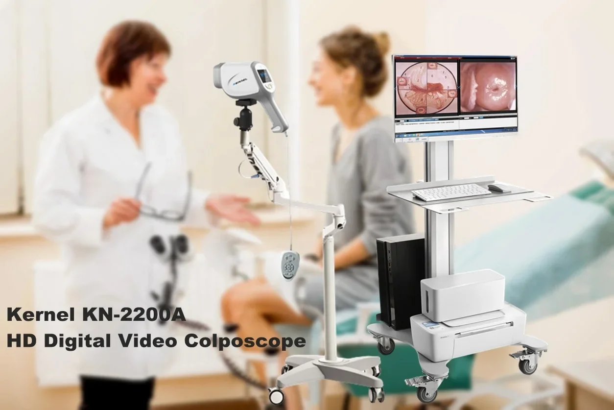 Digital Electronic Video Colposcopy for Gynecology/Portable  Gynecological Colposcopy Machine for Woman kernel kn2200