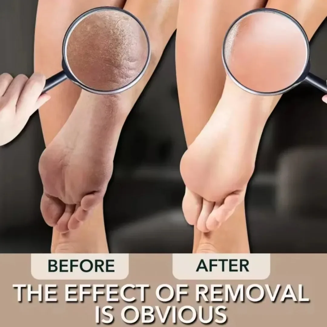 Nano Glass Foot File Double-sided Exfoliating Foot Grinder Hard Dead Skin Callus Remover Foot Scrubber Pedicure Feet Care Tools