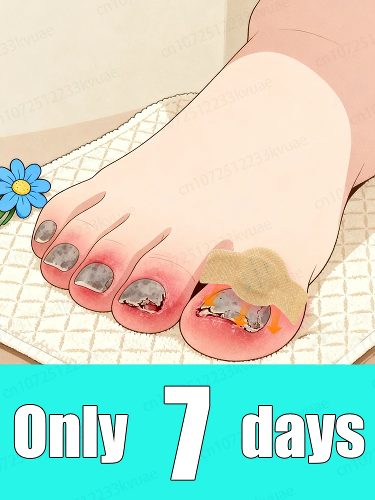 

Get rid of onychomycosis in 7 days and have normal nails