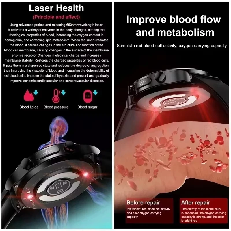 ECG+PPG Laser Therapy Smartwatch Health Monitor Blood Lipids Heart Rate Uric Acid Tracking Monitoring Men Smartwatch For Xiaomi