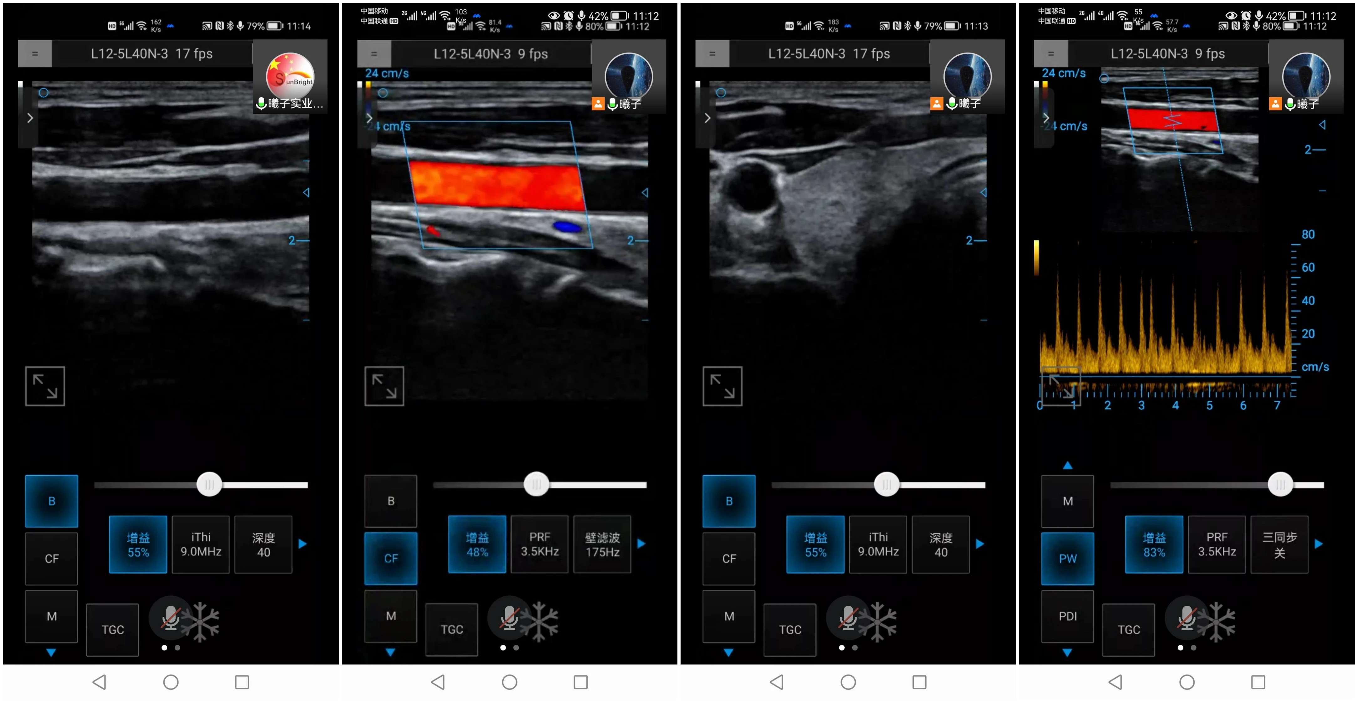 New Arrival USB Ultrasound Linear Array Probe Handheld Color Doppler Imaging System