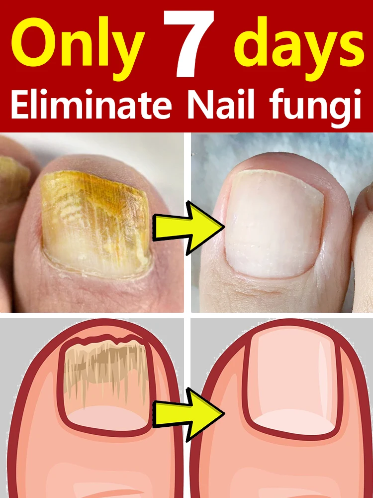 Get brand new nails instantly