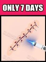 2025Generation-2, bolígrafo de luz azul para resolver cicatrices