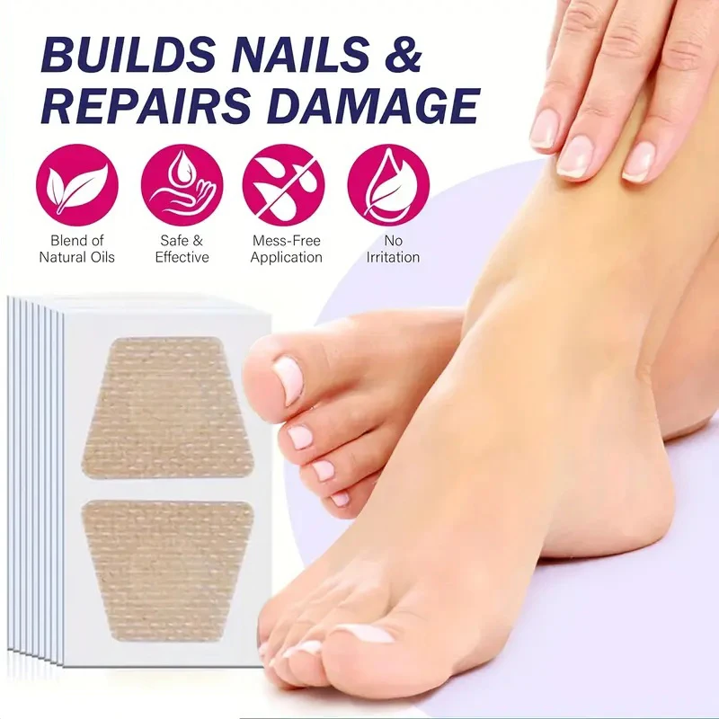 Nail Fungus Infection Repair Patch Toenails Discoloration Thicken Embedded Growth Orthopedic Bandage Breathable Foot Care Tools