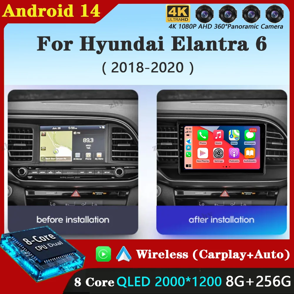 Android 14 Carplay Car Radio For Hyundai Elantra 6 2018 2019 2020 Navigation GPS Multimedia Player stereo WiF+4G BT 360 Camera