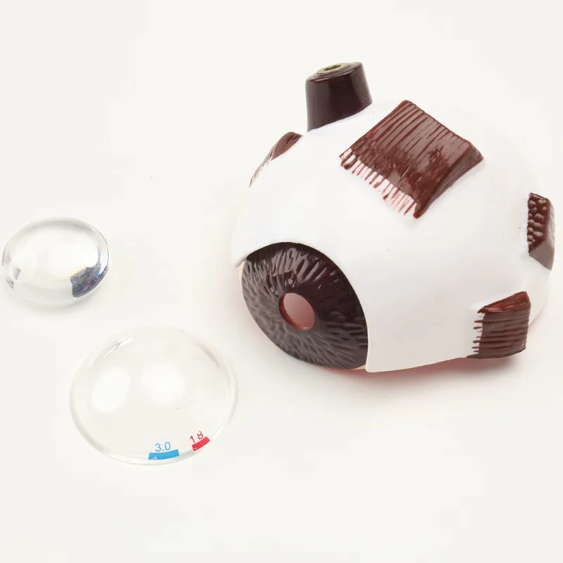 Cataract Eye Model Pathological Human Eye Structure Eye Anatomy Model Teaching Demonstration