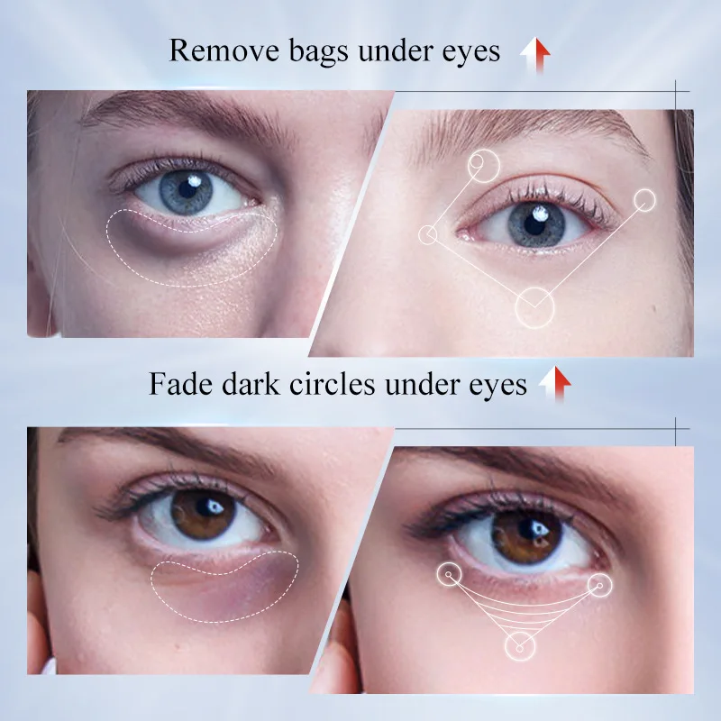 Kojic Acid Retinol Eye Cream Recuce Eye Dark Circles Decrease Eye Bags Moisturizing Firming Beauty Eyes Skin Care Products