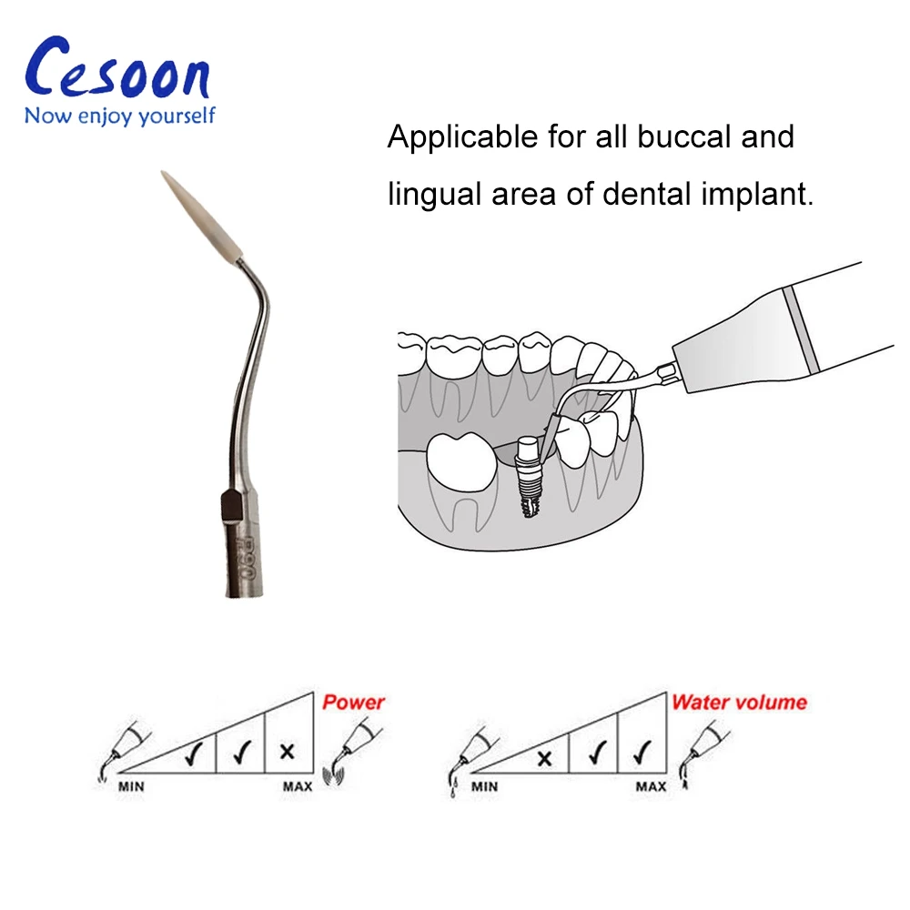 Cesoon 1 szt./2 szt. Stomatologiczny skaler ultradźwiękowy końcówki do czyszczenia implantu przyzębia P90 nadające się do skalerów dzięcioła