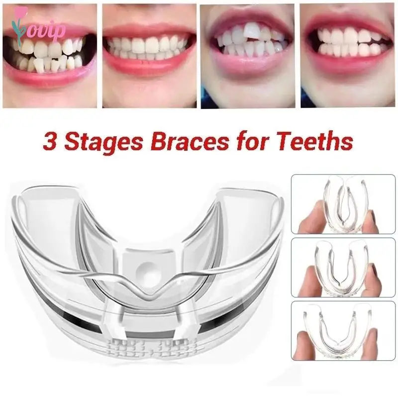 

Dental Orthodontic Teeth Corrector Braces Retainer Straighten Tools Tooth Care