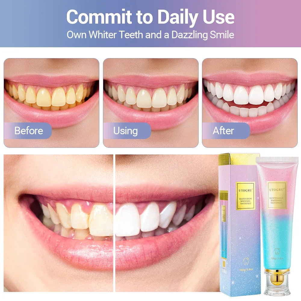 Thumbnail 2 - #5 Most Reviewed Toothpaste