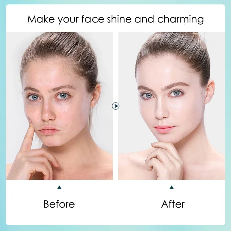 Thumbnail 4 - #40 Latest Skin Care Offers