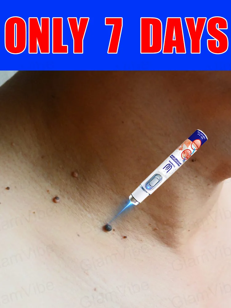 

blue light pen solve warts, hot sale wart care tools