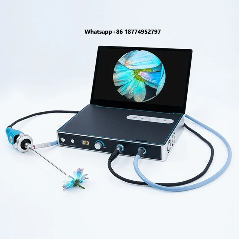 Medical integrated endoscopic system 1080P portable endoscopic  with display and LED light source for hysteroscopy