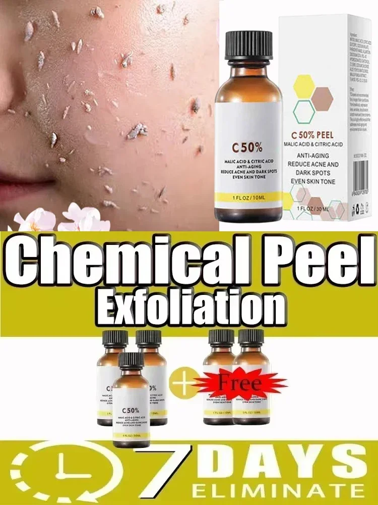 Face Care Exfoliating Yellow Peeling Oil Chemical Peel  Bleaching Dark Skin Remove Spots Arm Knee Legs Melanin Pigmentation