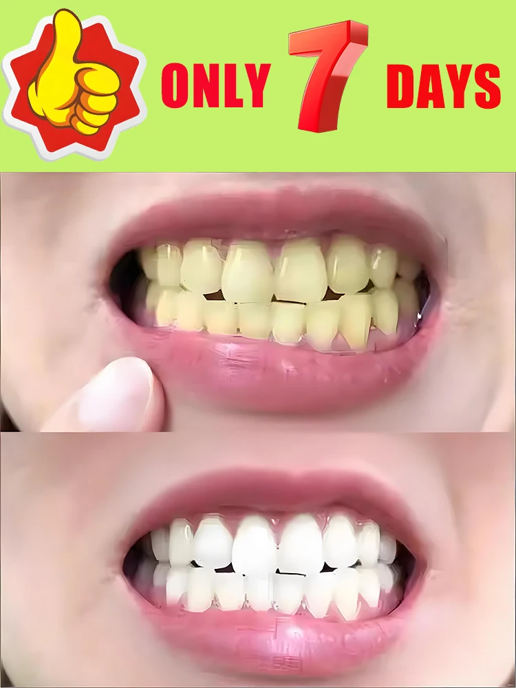 : Kit dentaire portable