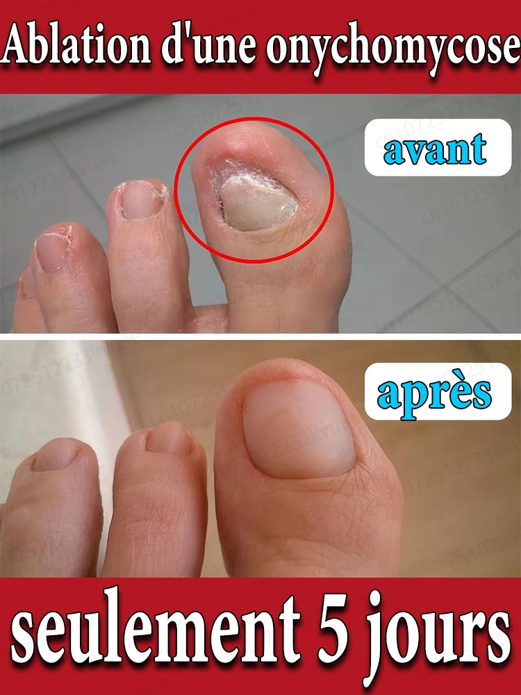 

Healthy feet, worry-free walking
