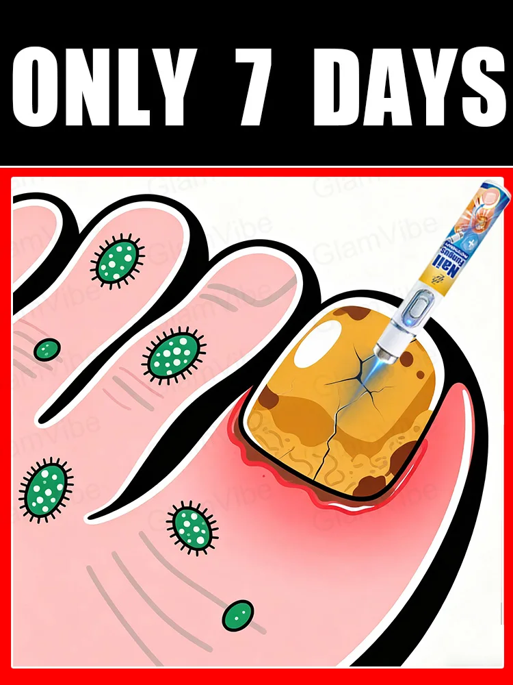 نسخة مطورة جديدة لعام 2025 من أداة معالجة فطريات الأظافر بالليزر الأزرق