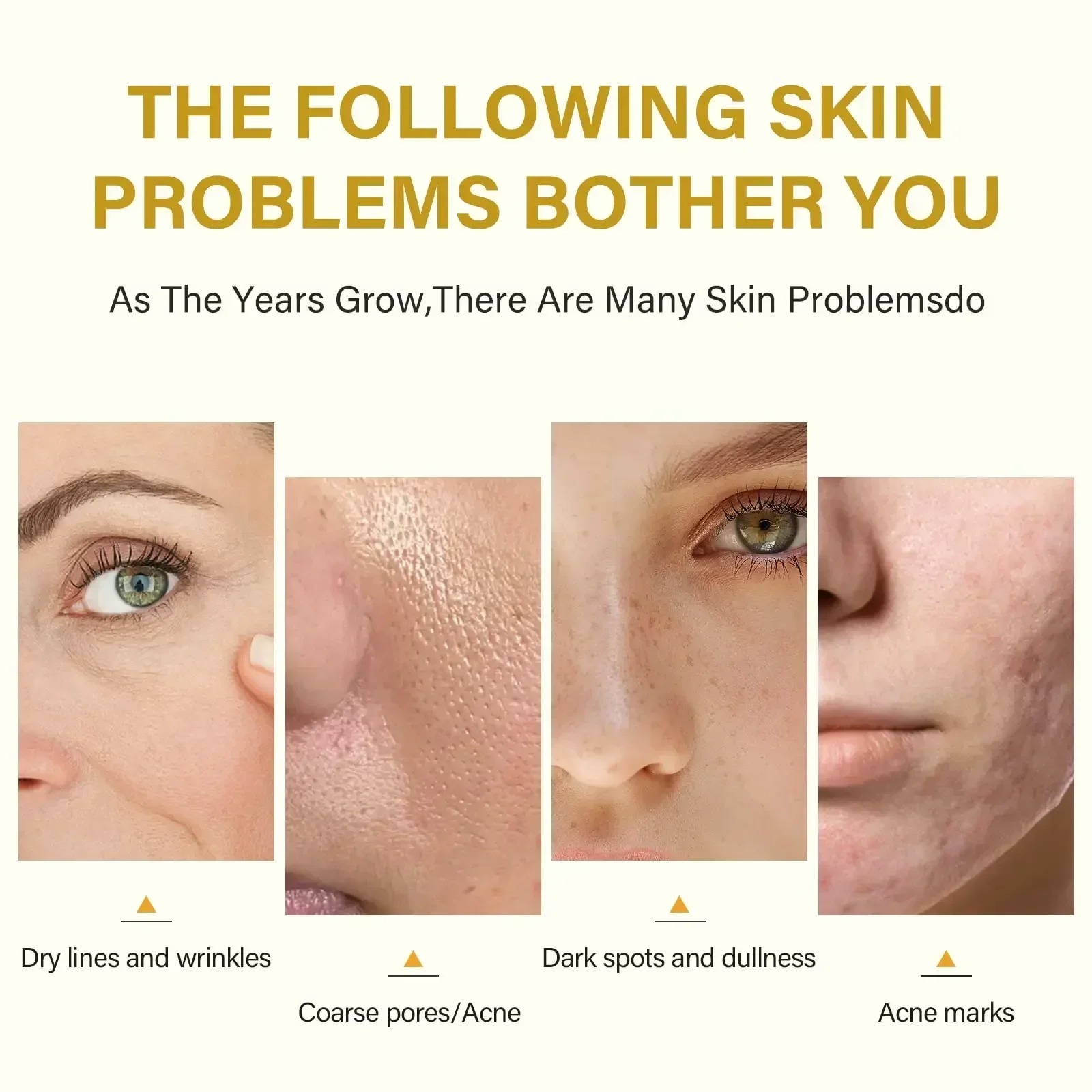 Face Care Skin care Moisturizing facial serum Exfoliating Peeling Oil Removing Melanin Plant essential oils