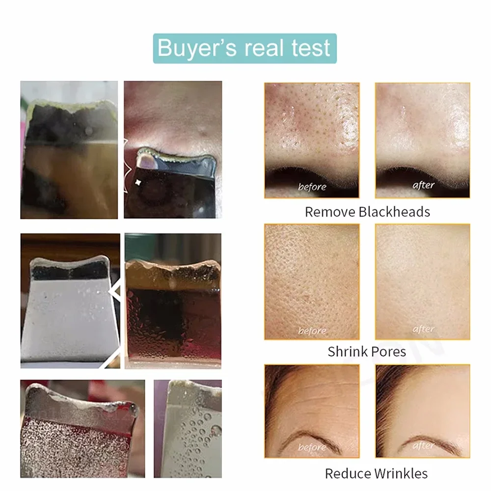متعددة الوظائف الكهربائية الجلد الغسيل تقشير مزيل الرؤوس السوداء تنظيف الوجه العميق رفع أيون حب الشباب المسام الأنظف تنظيف الوجه #5