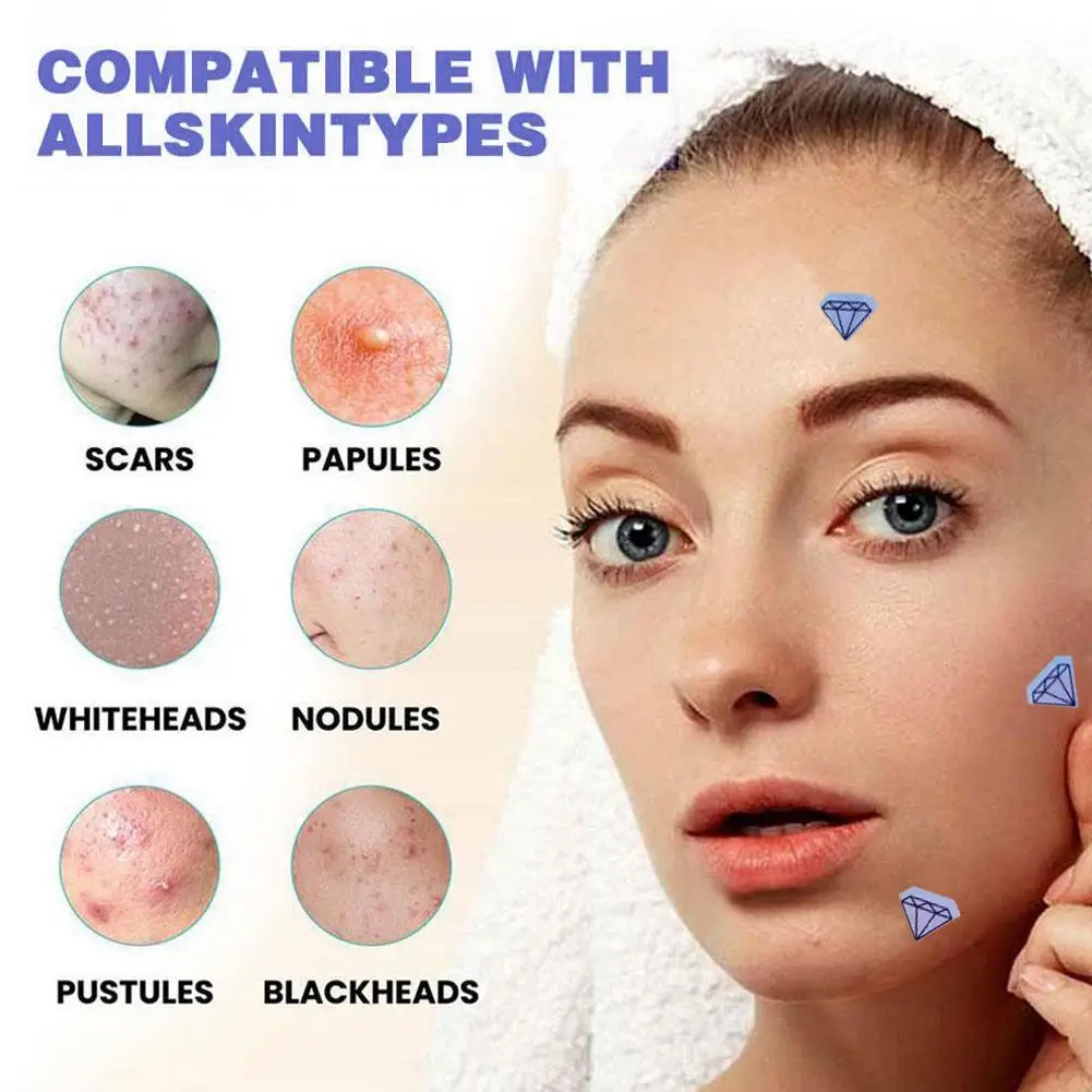 Patch anti-acné en diamant laser, traitement des boutons et des imperfections, soins respirants, beauté du visage, outils imperméables pour la peau, non irritSauU8D9