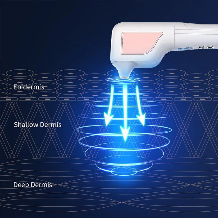 전문 얼굴 및 눈용 열 미용 기기 휴대용 미용 장비 주름 제거 눈 마사지기