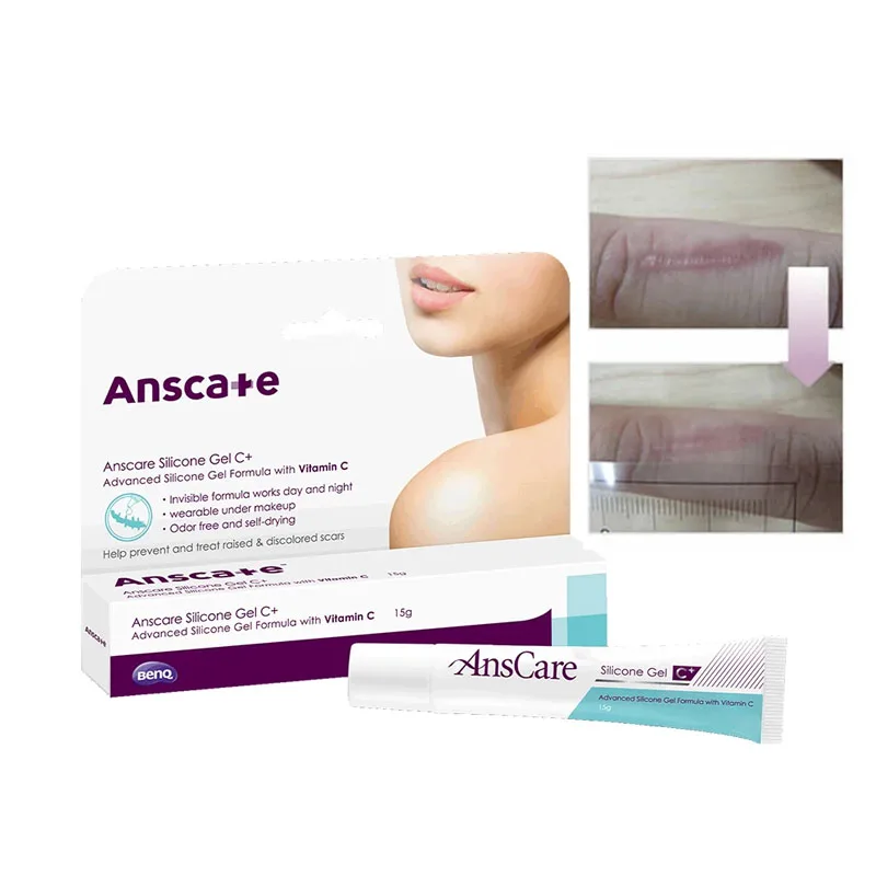 

Anscare Silicone Gel C+ 15g, For Scar Reduction Gel, Acne Scars, Surgery Burns Keloid Hypertrophic Scars Treatment, Skin Care