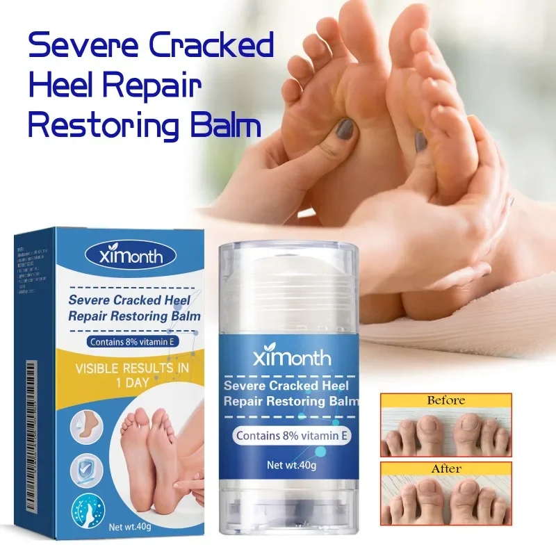 Severe Cracked Heel Repair Restoring Balm ป้องกันส้นเท้าแตก Repair Moisturizing Nourishing Stick Hand Feet Care 40g