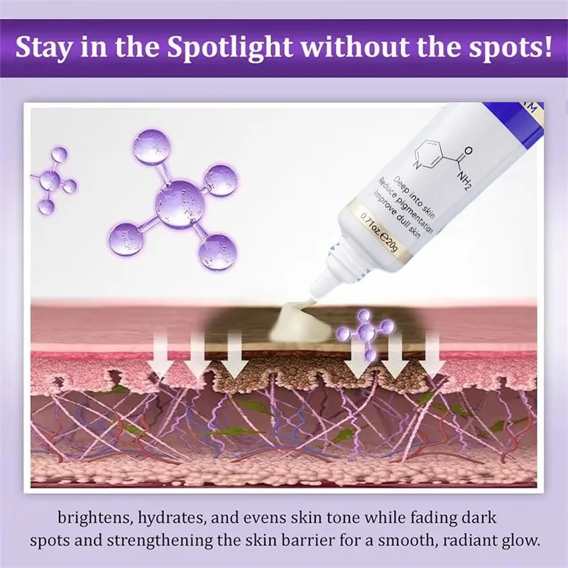 Crema schiarente per macchie Niacinamide Riduce cloasma Melasma Melanina Dissolvenza Linee sottili Dissolvenza Macchia scura Opaco Idratante Cura del viso