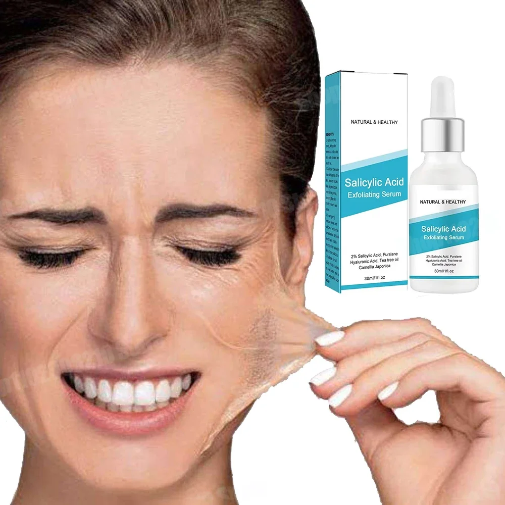 Acid Facial Skin Peel serum Chemical Chemical Peel for Pigmentation Acne SCARS WRINKLES ANTI-AGING PORES