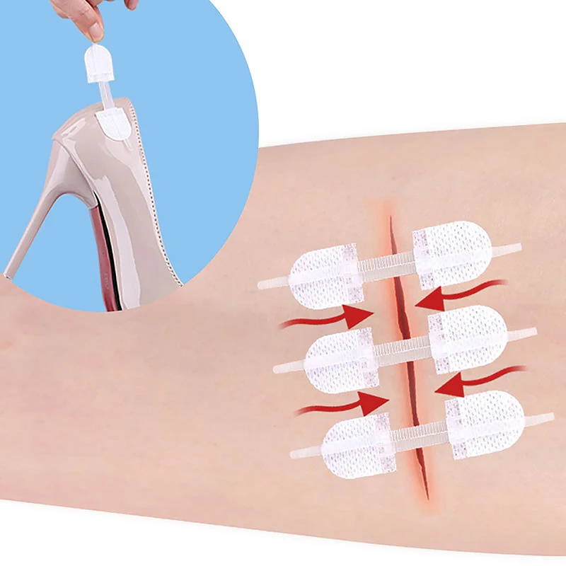 **3Pcs Zipper Tie Wound Closure Patch Hemostatic Patch Wound Fast Suture Zipper Band-Aid Outdoor Portable Skin Care