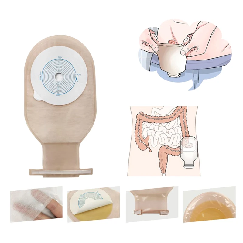 New Colostomy Bag Disposable Adhesive One Piece Drainable Ostomy Pouch Supplies For Ileostomy Disposable Colostomy Bag